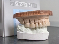 zirkon híd artikulációban zirkon híd artikulációban