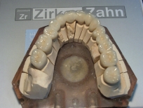 zirkon körhíd zirkon körhíd